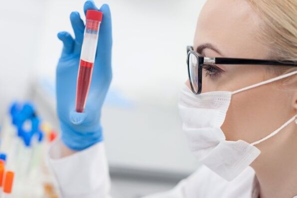 krvni test za hipertenzijo